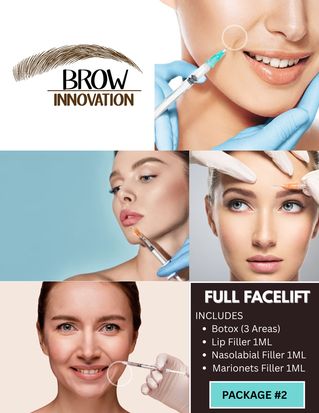 Full Facelift (Package #2)