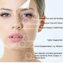 Load image into Gallery viewer, Microneedling Service
