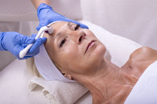 Load image into Gallery viewer, Microneedling Service
